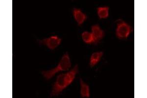 Immunofluorescence (fixed cells) (IF/ICC) image for anti-Small Ubiquitin Related Modifier Protein 1 (SUMO1) (N-Term) antibody (ABIN6265373)