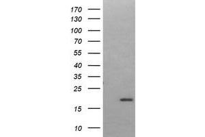 Image no. 1 for anti-LIM Domain Only 2 (Rhombotin-Like 1) (LMO2) antibody (ABIN1499188) (LMO2 antibody)