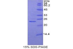 SDS-PAGE (SDS) image for Glutathione Synthetase (GSS) (AA 270-474) protein (His tag) (ABIN1878441) (Glutathione Synthetase Protein (GSS) (AA 270-474) (His tag))