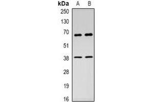 Western blot analysis of c-Rel expression in Hela (A), HEK293T (B) whole cell lysates. (c-Rel antibody  (C-Term))