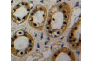Used in DAB staining on fromalin fixed paraffin-embedded Kidney tissue (CAP1 antibody  (AA 38-149))