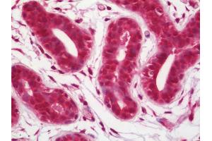 Human Breast: Formalin-Fixed, Paraffin-Embedded (FFPE)