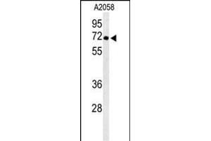 Western blot analysis of ATP6V1A Antibody (Center) (ABIN653735 and ABIN2843040) in  cell line lysates (35 μg/lane). (ATP6V1A antibody  (AA 441-468))