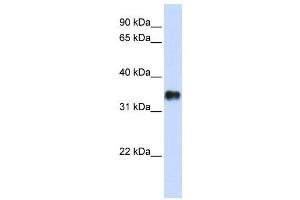 Western Blotting (WB) image for anti-Potassium Channel Tetramerisation Domain Containing 7 (KCTD7) antibody (ABIN2458146)