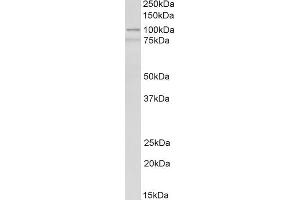 ABIN2613374 (0. (ACTN1 antibody  (AA 596-609))
