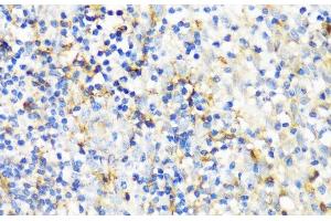 Immunohistochemistry of paraffin-embedded Human tonsil using ITGAX Polyclonal Antibody at dilution of 1:100 (40x lens).