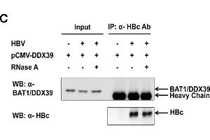 Association between HBc ARD and TREX complex.