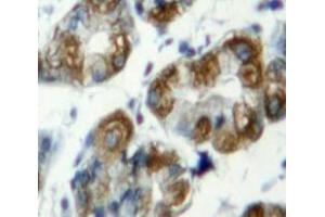 Used in DAB staining on fromalin fixed paraffin-embedded Stomach tissue (TLR7 antibody  (AA 887-1036))
