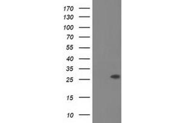 OTUB2 antibody