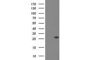 Western Blotting (WB) image for anti-OTU Domain, Ubiquitin Aldehyde Binding 2 (OTUB2) antibody (ABIN1499938) (OTUB2 antibody)