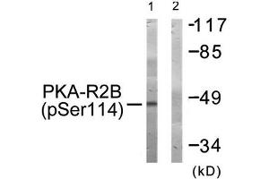 Western blot analysis of extracts from COS-7 cells treated with PMA using PKA-R2β (Phospho-Ser114) Antibody. (PRKAR2B antibody  (pSer113))