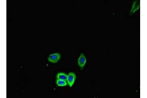 Immunofluorescent analysis of HepG2 cells using ABIN7177169 at dilution of 1:100 and Alexa Fluor 488-congugated AffiniPure Goat Anti-Rabbit IgG(H+L) (GRP78 antibody  (AA 20-655))