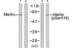 Western blot analysis of extracts from H (Merlin antibody  (pSer518))
