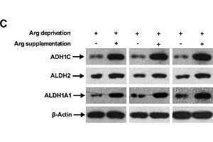 ADH1C anticorps  (AA 1-375)