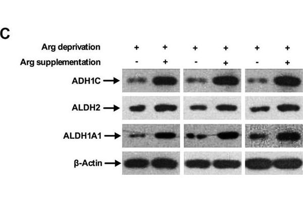 ADH1C anticorps  (AA 1-375)