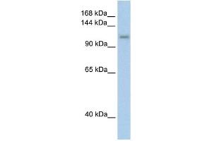 WB Suggested Anti-PRPF6 Antibody Titration:  2. (PRP6/ANT-1 antibody  (C-Term))