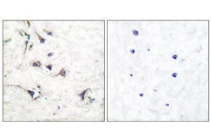 Immunohistochemistry (IHC) image for anti-Ezrin (EZR) (C-Term) antibody (ABIN1848533) (Ezrin antibody  (C-Term))