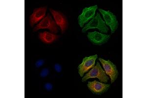 ABIN6255799 and ABIN6277803 staining Hela cells(4h of LPS treatment) by IF/ICC.