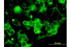 Immunofluorescence of purified MaxPab antibody to RETN on 293 cell.