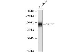 Western blot analysis of extracts of Rat brain, using S antibody (ABIN7270152) at 1:500 dilution. (SATB2 antibody)