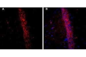 Expression of KCNQ2 in rat brain - Immunohistochemical staining of free-floating frozen rat hippocampal CA1 region sections using Guinea pig Anti-KCNQ2 Antibody (ABIN7043504, ABIN7045416 and ABIN7045417), (1:200). (KCNQ2 antibody  (C-Term, Intracellular))