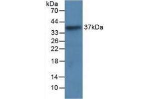 Western blot analysis of recombinant Human LRG1. (LRG1 antibody  (AA 37-340))