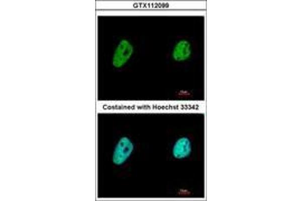 TCERG1 antibody  (AA 419-1077)