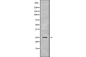 Western blot analysis of PSMD9 using HepG2 whole cell lysates (PSMD9 antibody  (N-Term))