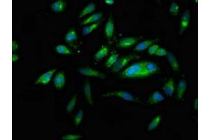 Immunofluorescence staining of Hela cells with ABIN7161406 at 1:166, counter-stained with DAPI. (PNPLA6 antibody  (AA 345-493))