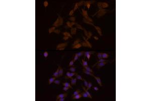 Immunofluorescence analysis of PC-12 cells using PFKFB3 Rabbit mAb (ABIN1680620, ABIN3018306, ABIN3018307 and ABIN7101590) at dilution of 1:100 (40x lens). (PFKFB3 antibody)
