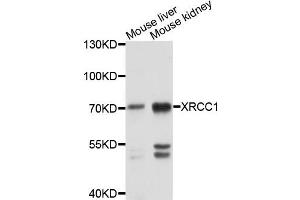 Western blot analysis of extracts of mouse liver and mouse kindney cells, using XRCC1 antibody. (XRCC1 antibody)
