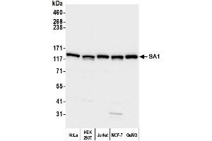 Western Blotting (WB) image for anti-Stromal Antigen 1 (STAG1) (AA 1150-1200) antibody (ABIN7453338)
