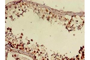 Immunohistochemistry (IHC) image for anti-Doublesex and Mab-3 Related Transcription Factor 1 (DMRT1) (AA 195-363) antibody (ABIN7150637)