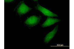 Immunofluorescence of purified MaxPab antibody to NEDD9 on HeLa cell. (NEDD9 antibody  (AA 1-834))