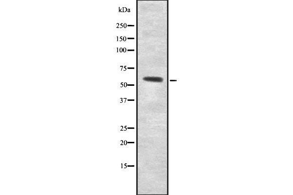 UGT8 antibody  (Internal Region)