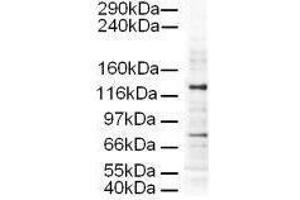 Western blot using  Affinity Purified anti-AP3D1 antibody shows detection of a 130-kDa band corresponding to Human AP3D1 in a HeLa whole cell lysate. (AP3D1 antibody  (AA 686-698))