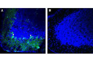 Expression of Robo3 in rat cerebellum.