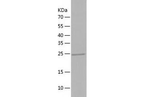 VTI1B Protein (AA 1-208) (His tag)