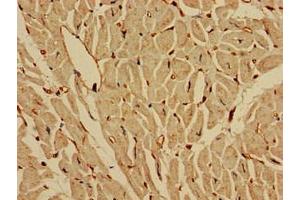 Immunohistochemistry of paraffin-embedded human heart tissue using ABIN7157046 at dilution of 1:100 (IREB2 antibody  (AA 107-216))