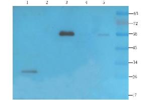 Western Blot using anti-VEGF antibody  Rat thyroid (lane 1), rat bladder (lane 2), mouse brain (lane 3), human thyroid cancer (lane 4) and human ovarian cancer (lane 5) samples were resolved on a 12% SDS PAGE gel and blots probed with  at 2 µg/ml before being detected by a secondary antibody. (Recombinant VEGF antibody)