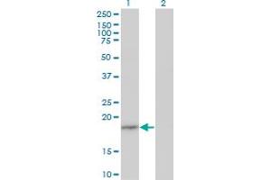 Western Blot analysis of EIF1AY expression in transfected 293T cell line by EIF1AY monoclonal antibody (M01), clone 1B4. (EIF1AY antibody  (AA 22-95))