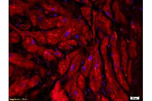 Formalin-fixed and paraffin embedded human myocardial tissue labeled with Anti-CT-1/CTF1 Polyclonal Antibody, Unconjugated (ABIN741675) followed by conjugation to the secondary antibody (Cardiotrophin 1 antibody  (AA 121-201))