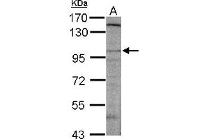 Western Blotting (WB) image for anti-Discs, Large (Drosophila) Homolog-Associated Protein 2 (DLGAP2) (AA 1-47) antibody (ABIN1502171)