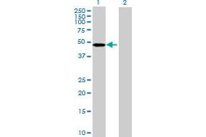 Western Blot analysis of ARMC6 expression in transfected 293T cell line by ARMC6 MaxPab polyclonal antibody. (ARMC6 antibody  (AA 1-476))