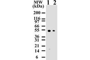 Image no. 1 for anti-Caspase 8 (CASP8) (AA 217-222) antibody (ABIN207902) (Caspase 8 antibody  (AA 217-222))
