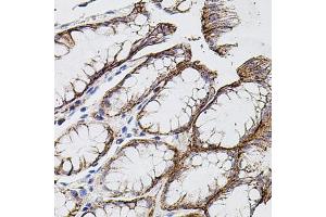 Immunohistochemistry of paraffin-embedded human stomach using MMP9 antibody (ABIN4904400) at dilution of 1:100 (40x lens).