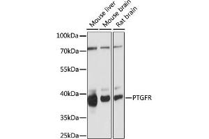 Western blot analysis of extracts of various cell lines, using PTGFR antibody (ABIN7269574) at 1:1000 dilution. (PTGFR antibody  (AA 50-150))