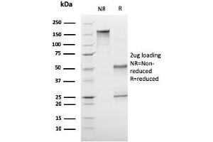 SDS-PAGE Analysis Purified CD1a Mouse Monoclonal Antibody (C1A/3249). (CD1a antibody  (AA 43-173))