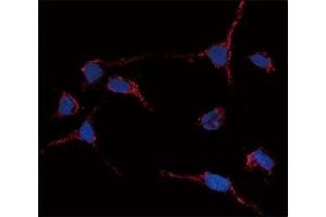 Immunofluorescence analysis of anti-ALDH1A1 antibody and HeLa cells. (ALDH1A1 antibody  (AA 302-331))