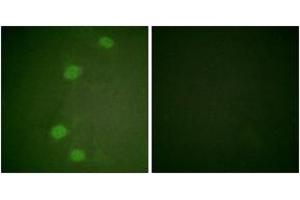 Immunofluorescence analysis of HeLa cells, using Retinoblastoma (Phospho-Ser249) Antibody. (Retinoblastoma Protein (Rb) antibody  (pSer249))
